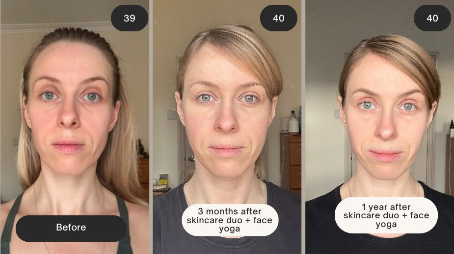 I Started Ageing at 18 — My Path to Becoming a Face Yoga Expert