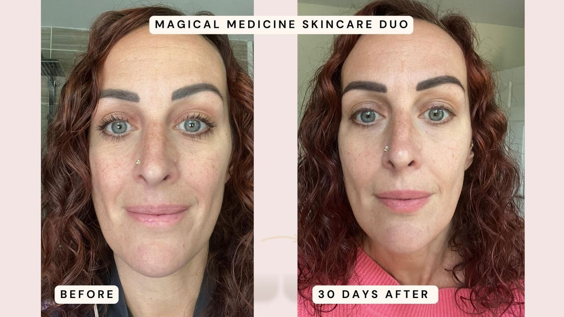 Caroline’s Glow-Up Using Magical Medicine Skincare Duo